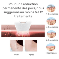 Épilateur à lumière pulsée IPL – Épilation Définitive à Domicile